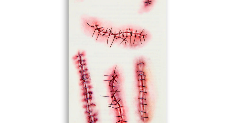 Widmann SRL 10 Tattoos met nietjes en hechtingen