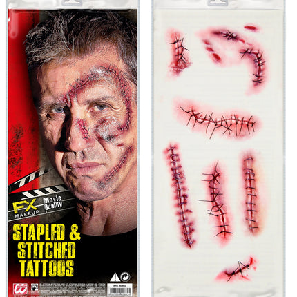 Widmann SRL 10 Tattoos met nietjes en hechtingen