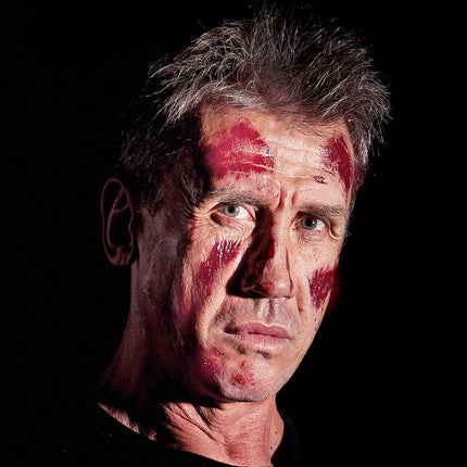 Widmann SRL 6 Brandwond tattoo nep