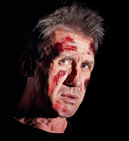 Widmann SRL 6 Brandwond tattoo nep