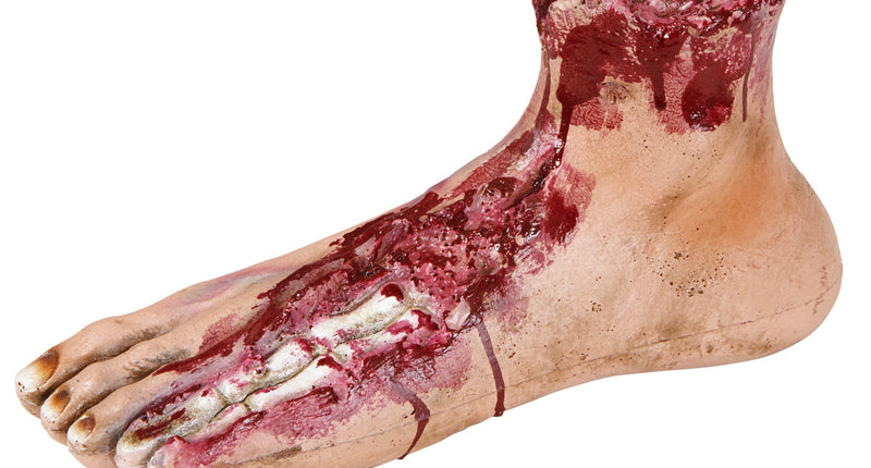 Widmann SRL Afgehakte voet van een mens