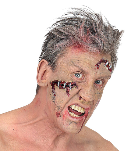 Widmann SRL Open wond klein met nietjes