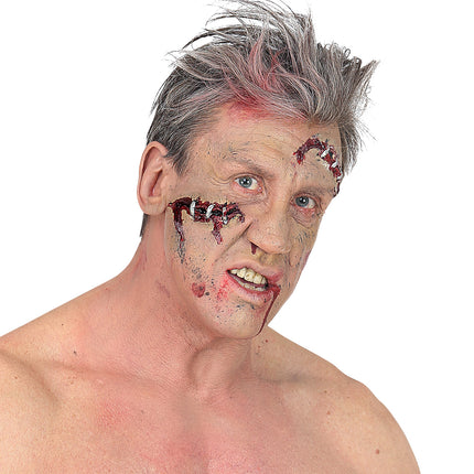 Widmann SRL Open wond klein met nietjes