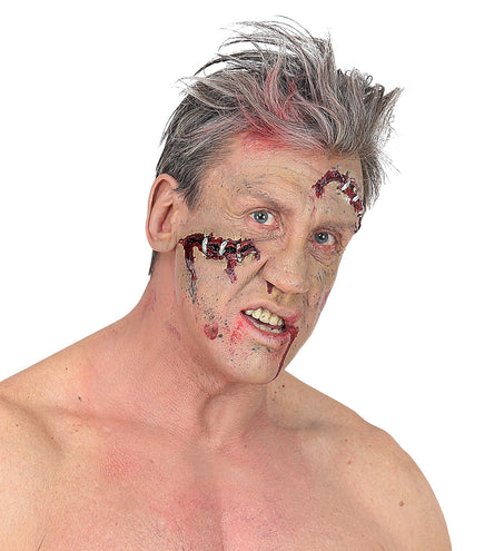 Widmann SRL Open wond klein met nietjes