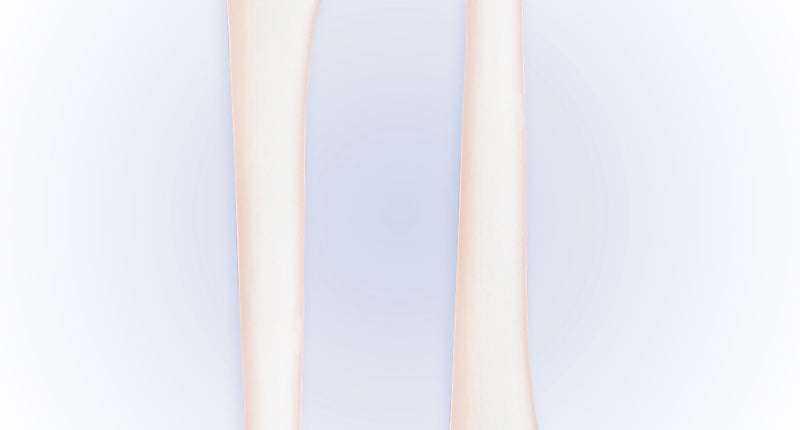 Widmann SRL Set Van 2 Botjes 23Cm